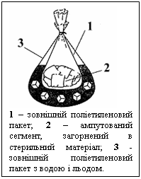 :  &#13;&#10;1    ; 2   ,    ; 3 -       .&#13;&#10;